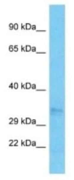 OR52N5 Rabbit anti-Human, Polyclonal, Novus Biologicals:Antibodies:Primary